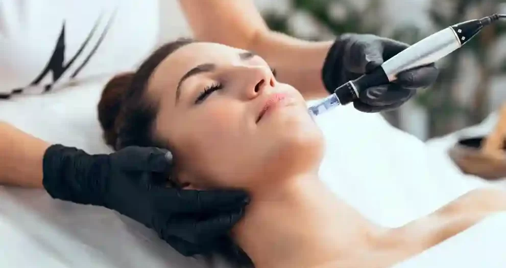 Microneedling