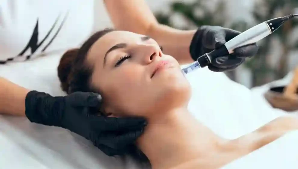 Microneedling